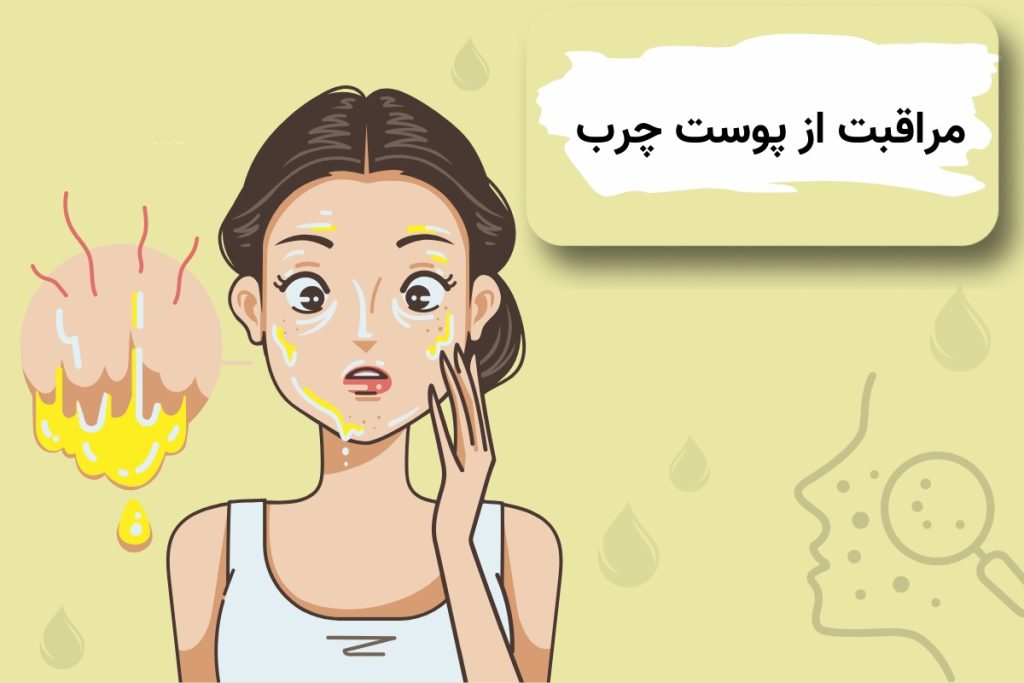 چگونه از پوست چرب مراقبت کنیم؟